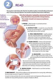 We did not find results for: Rn Ppd Test Facebook