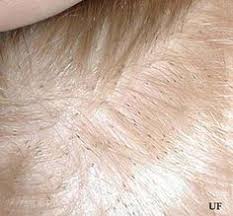 How to find closest hair salon near me you might ask? 12 Lice Removal Service Salon Ideas Lice Removal Head Lice Removal Head Louse