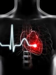 Este juego que tiene enviciados a muchos chiapanecos, trae sus consecuencias en caso no se tomen las medidas. Extrasistoles Causas Sintomas Y Tratamiento Latidos De Corazon Imagenes De Paramedicos Pintura De Corazon