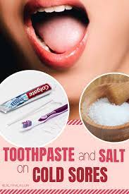 Pin By Suga On Cold Sores Remedies Cold Sores Remedies Natural Cough Remedies Cold Sore
