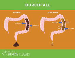 Doch im medizinischen sinne liegt durchfall erst dann vor, wenn der stuhlgang drei mal oder häufiger am tag erfolgt und weitere kriterien erfüllt sind. Durchfall Naturheilpraxis Gesund In Berlin