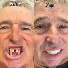 Marin Dental Implant Center