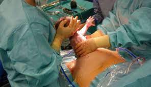 Ada beberapa treatment yang perlu ibu dan bayi dapatkan untuk menunjang. Persiapan Melahirkan Caesar Yang Tak Boleh Ketinggalan Aladokter