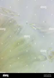 Image result for Chlorosplenium chlora