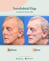 Wake Forest Baptist Facial Plastic & Reconstructive Surgery added a new  photo — at Wake Forest Baptist Facial Plastic & Reconstructive...