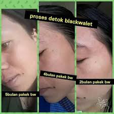 Leave the mask on for 20 minutes and then rinse off with warm water and a washcloth. Blackwalet Bandung Postingan Facebook