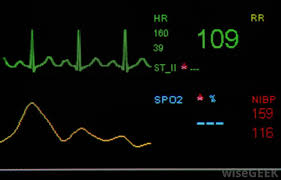What Is A Resting Heart Rate Chart With Pictures