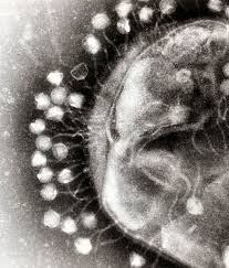This virus is about 150 nm by 50 nm. Viral Diversity Boundless Microbiology