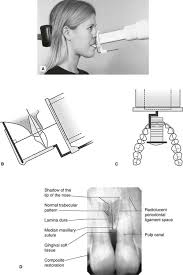 periapical radiography pocket dentistry