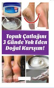 Topuk Catlaklari Icin Super Etkili Karsim Health Health Benefits Of Ginger Health Fitness Nutrition