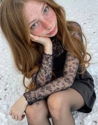 would you kiss me if my freckles were contagious?