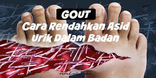 Cara merawat gout secara konvensional & alternatif yang via providenetwork.com. Gout Cara Rendahkan Asid Urik Dalam Badan Bebelsihat Com