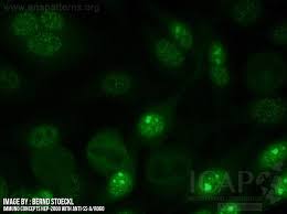 Image result for ANA Staining Pattern