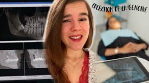 GREFFE DE GENCIVE (expérience, douleur, prix)