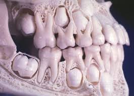 An 8 Year Old S Skull Teeth Skull Teeth Teething Baby Dental Art Dental Laboratory Childs Skull