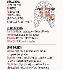 Image result for Point of Maximum Impulse