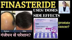 Get finasteride at best price from finasteride proscar is a brand name owned by the american pharmaceutical concern merck & co. Finasteride Finpecia Uses Doses Side Effects In Hindi à¤— à¤œ à¤ªà¤¨ à¤• à¤¦à¤µ à¤ˆ Youtube