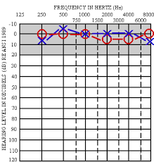 audiometry