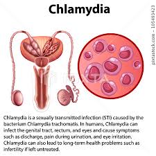 Image result for Chlamydia Trachomatis