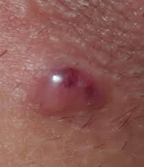 557 860 просмотров 557 тыс. Was Ist Das Und Was Soll Ich Tun Schmerzen Intimbereich Scheide
