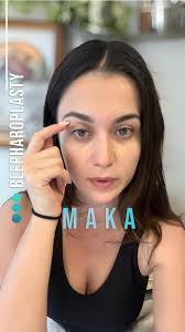 Blepharoplasty ✨, For detailed information;, ☎ +90 538 659 60 00, 📧  info@renateclinic.com, 📍Istanbul