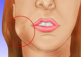 Symptoms of an infected tooth can include: Wisdom Tooth Infection How To Treat Infected Tooth