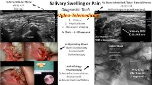 Image result for Submandibular Exam