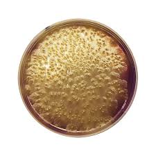 Clostridium perfringens is the most common clinical isolate of the genus. Clostridium Perfringens Agar Base M Cp Formato 500 G