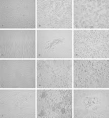 We did not find results for: Role Of Cell Culture For Virus Detection In The Age Of Technology Clinical Microbiology Reviews