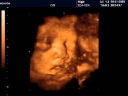 32 haftalik hamilelikte 4 boyutlu ultrason goruntusu youtube