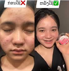 📍ຮ້ານ18shop👗👘👠ຂາຍທຸກຢ່າງ