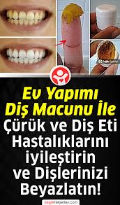 Ev Yapimi Dogal Dis Macunu Ile Curuklere Ve Dis Eti Hastaliklarina Son 2020 Dogal Dis Dogal Saglik