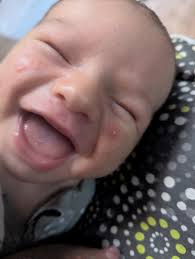 Newborn baby skin rash treatment?