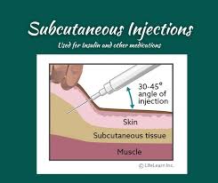 Image result for Subcutaneous Injection