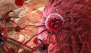 Use the menu below to choose the introduction section to get started. Prostate Cancer Symptoms Diagnosis Treatment à¤¨à¤ à¤¤à¤°à¤¹ à¤• à¤ª à¤° à¤¸ à¤Ÿ à¤Ÿ à¤• à¤¸à¤° à¤• à¤¹ à¤ˆ à¤ªà¤¹à¤š à¤¨ à¤œ à¤¨ à¤ à¤‡à¤¸à¤• à¤²à¤• à¤·à¤£ India Tv Hindi News
