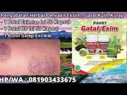 Pin Di Obat Gatal Jamur Selakangan