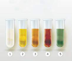 If the fresh urine, for example, smells strongly of ammonia, this may be an indication of a urinary tract infection. Que Dit La Couleur De L Urine Sur Votre Sante 5 Couleurs D Urine Et Ce Qu Elles Signifient Oui L Urine Verte Existe Sante Epoch Times