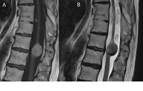 Pin On Radiology