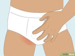 Image result for pubic lice symptoms