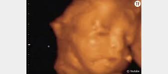 Cette étape de la grossesse est caractérisée par le développement du cerveau du bébé ainsi que l'arrivée à maturité des organes sensoriels du bébé. Une Video Saisissante En 4d D Un Bebe Dans Le Ventre De Sa Maman Terrafemina