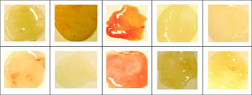 Reproducibility Of The Sputum Color Evaluation Depends On