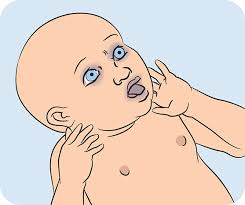 This a quality and engaging course. Choking First Aid For Babies In Pictures Raising Children Network