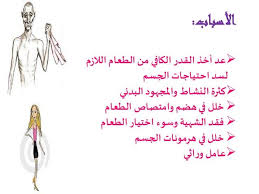 السمنة والنحافة وفقر الدم Personalized Items Person