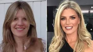 Achei esse vídeo que mostra a mudança física e de estilo musical da luísa sonza e achei irado trazer pra vocês.canal master tretas. Mae De Luisa Sonza Fez Harmonizacao Facial Com Botox Preenchimento E Rinoplastia Famosos Extra Online
