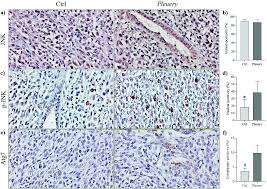 .dan meraih beasiswa luar negeri канала unipa kampus lamongan. Jnk Pathway And Heat Shock Response Mediate The Survival Of C26 Colon Carcinoma Bearing Mice Fed With The Mushroom Pleurotus Eryngii Var Eryngii With Food Function Rsc Publishing Doi 10 1039 D0fo03171b