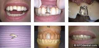 Dr Jeffrey Dorfman Dentist
