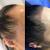 Hairstyles To Hide Hair Loss