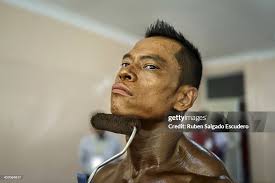 Phanorn Onnim of Thailand gets tanned up before competing in the... News  Photo