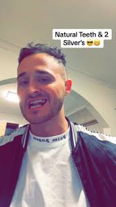 Natural Teeth and Silver Fillings Explained