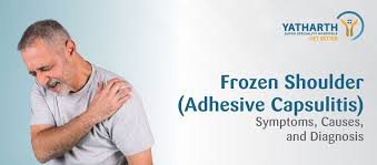 Image result for Frozen Shoulder